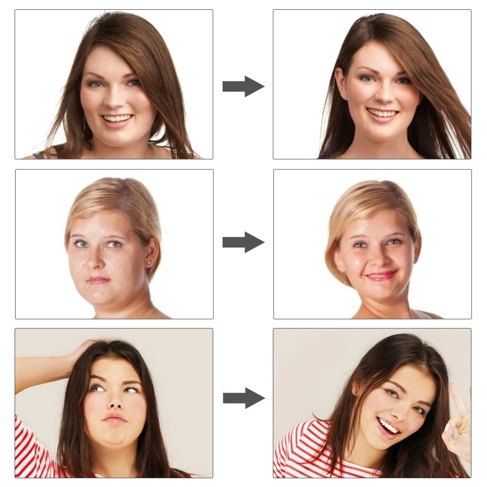 V-Shape | Sistema de Definición Facial