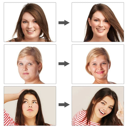 V-Shape | Sistema de Definición Facial